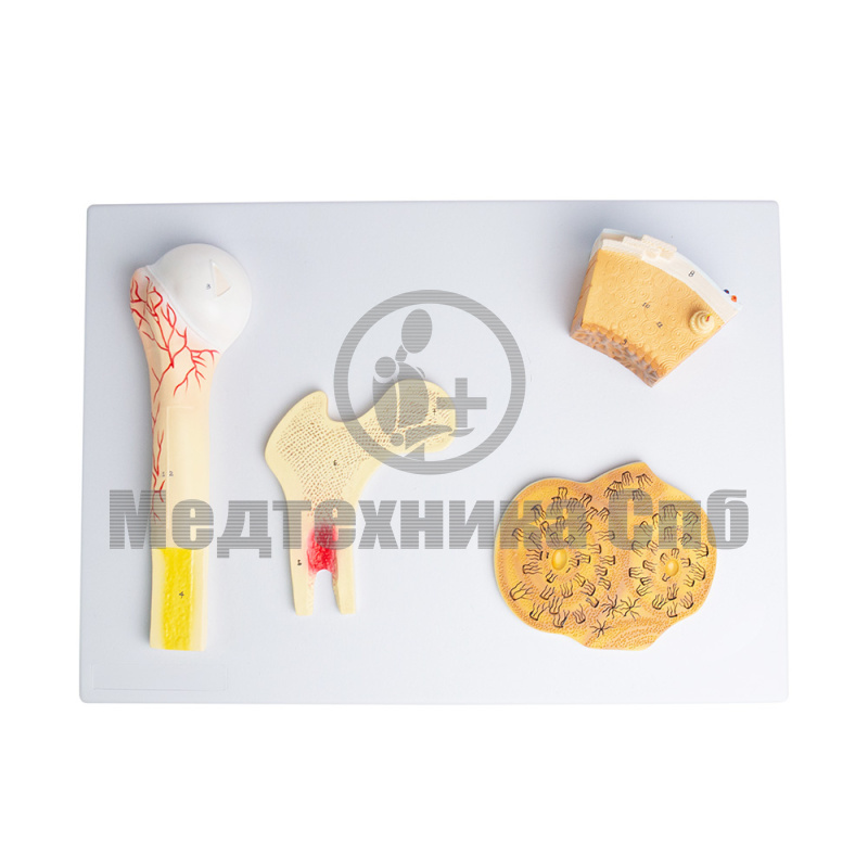 P0281 Модель структуры костей, 4 части