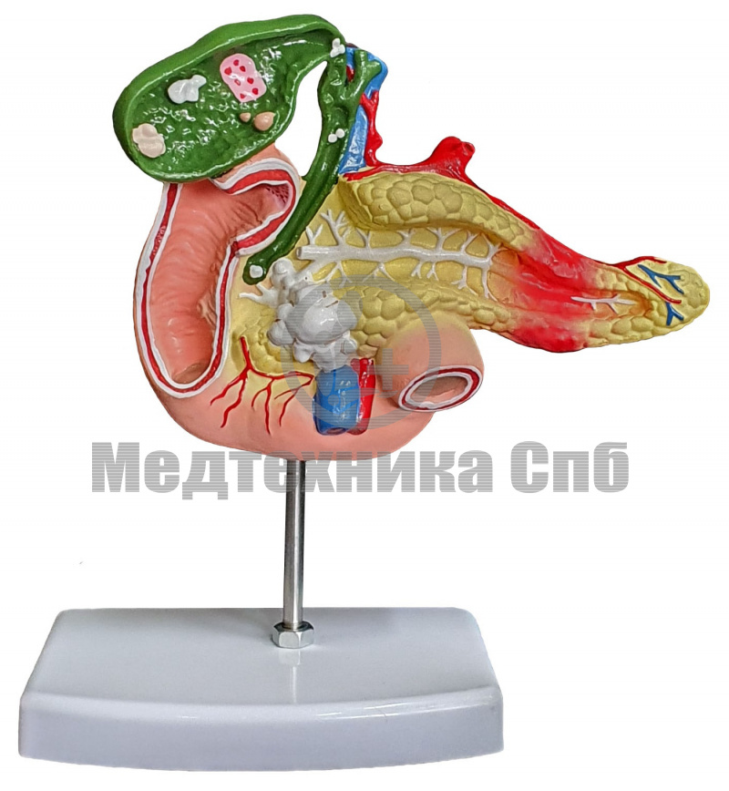 изображение: Модель патологий поджелудочной железы  и желчного пузыря