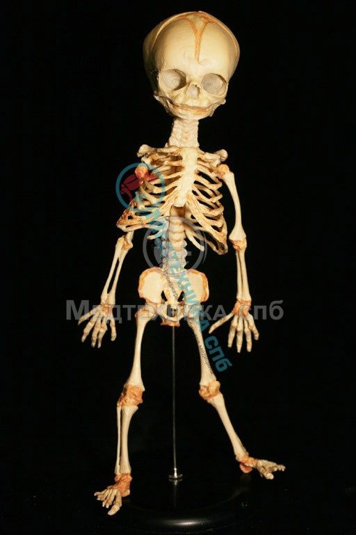 изображение: Муляж скелета плода