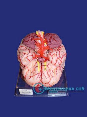 изображение: Модель головного мозга с артериями