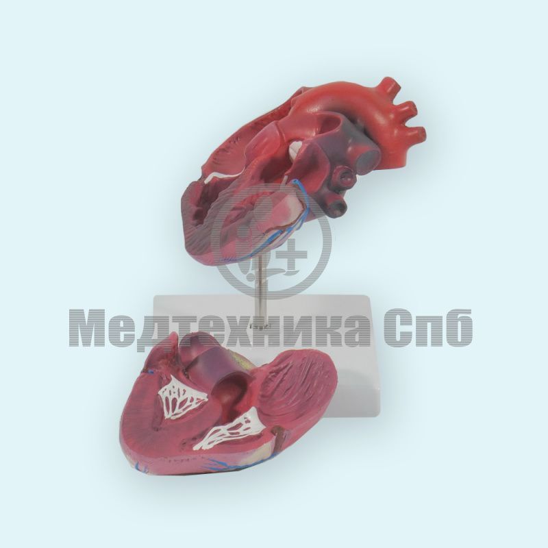 Демонстративная модель сердца с гипертрофией
