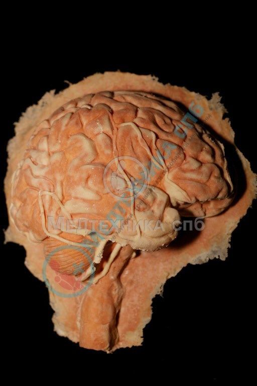 изображение: Фантом головного мозга (нераскрашенный)