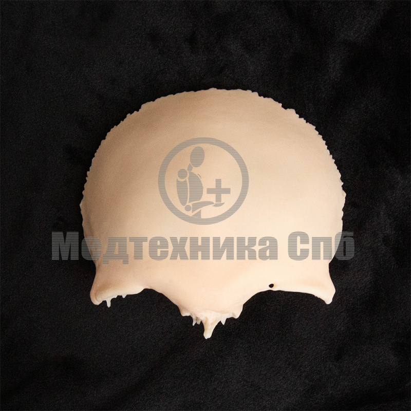 KS011 Лобная кость
