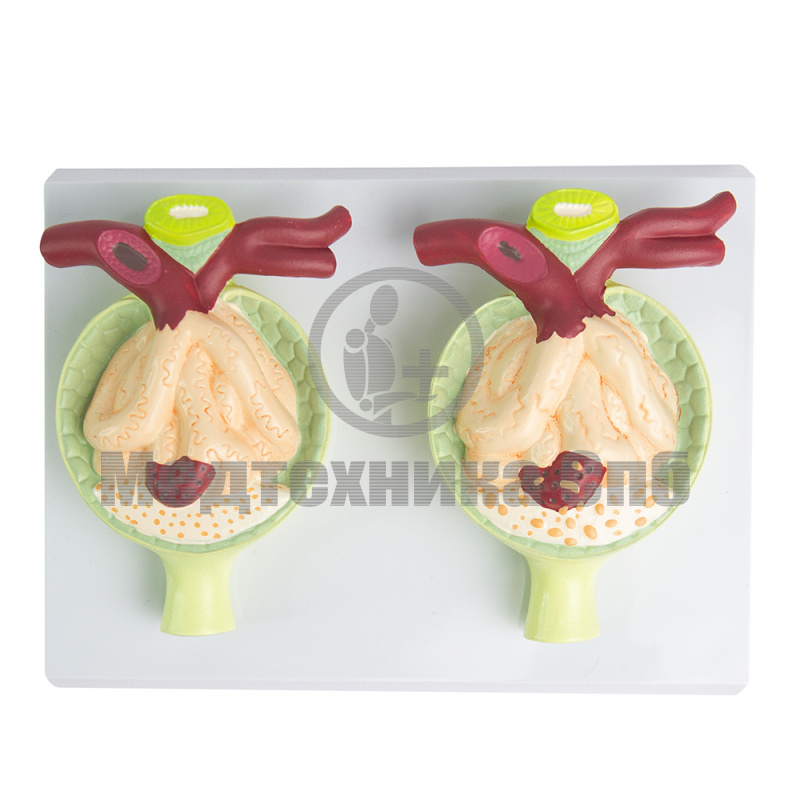 P0760 Модель патологий нефрона, 2 части