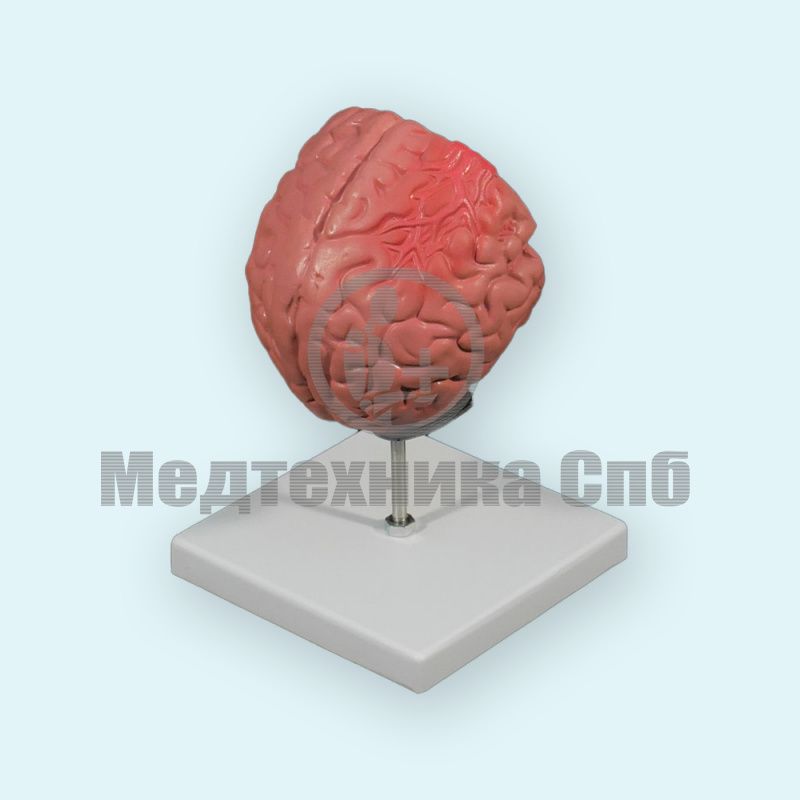 изображение: Модель патологий головного мозга (на подставке)