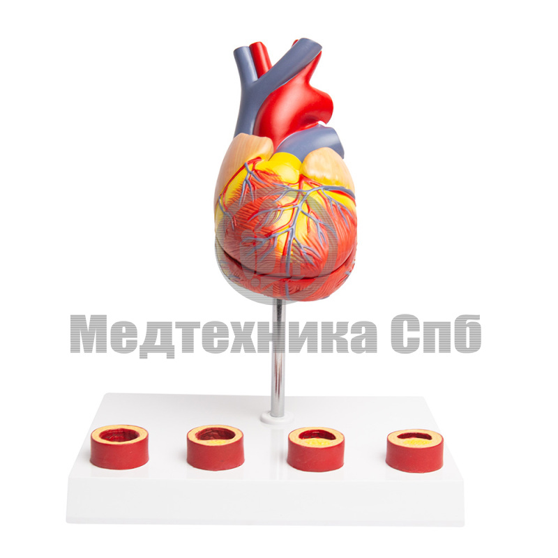 Модель сердца и патологии артерий