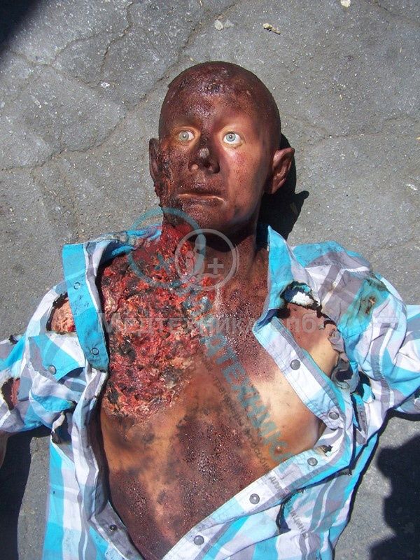 изображение: Фантом-манекен обожжённого тела Джо, наполовину анатомический