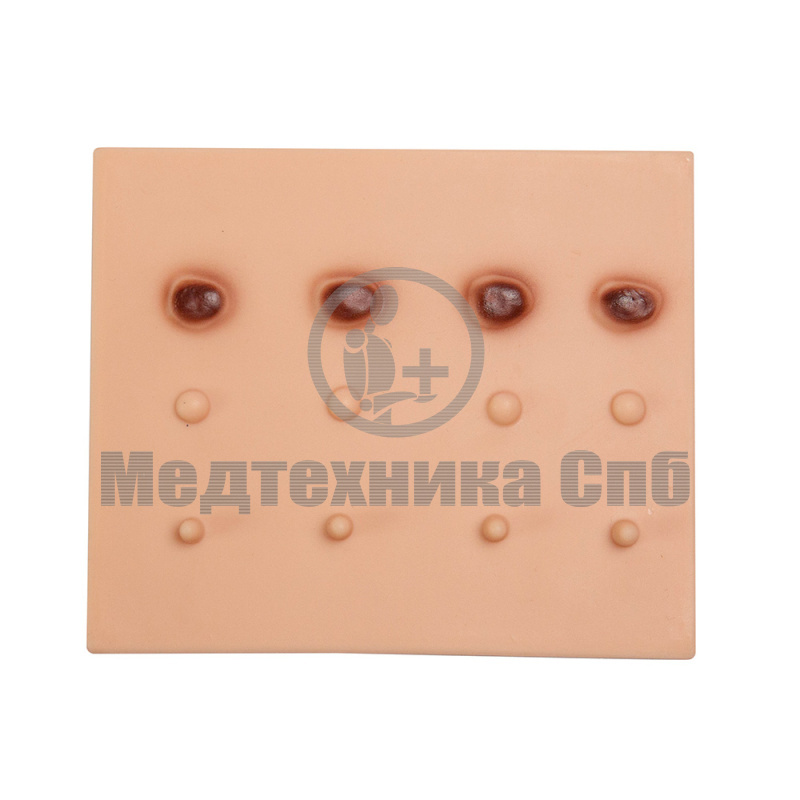 Подушечка с папилломами, невусами и себорейным кератозом