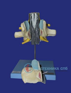 изображение: Модель поясничного позвонка со спинным мозгом и нервами конского хвоста