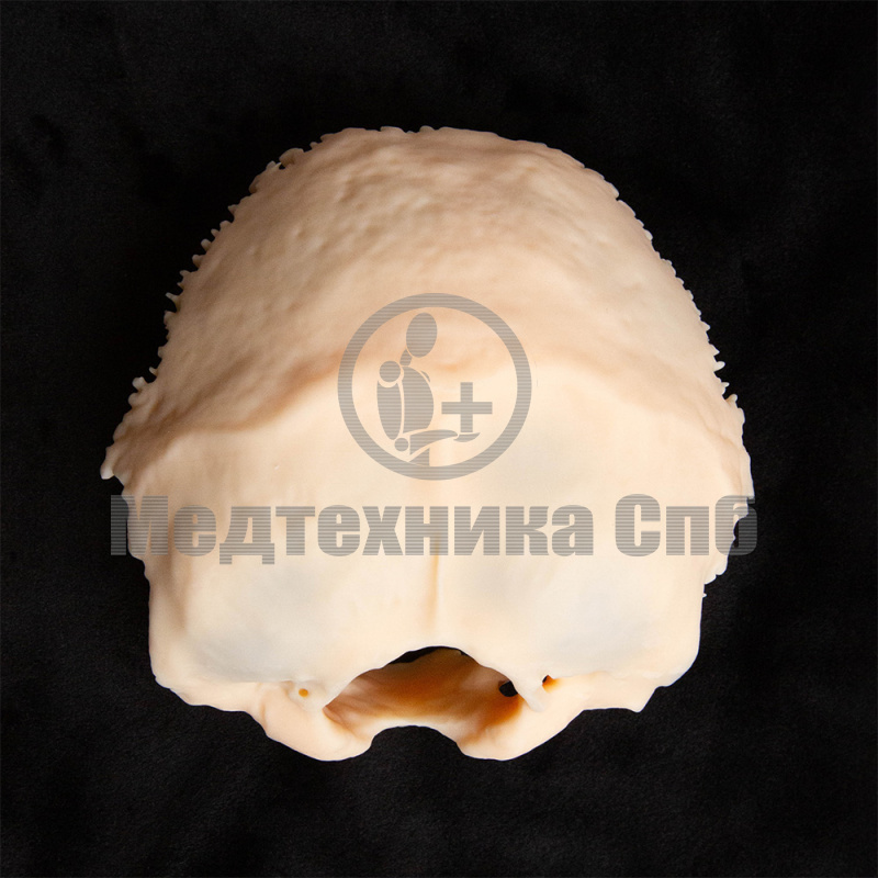 KS004 Затылочная кость