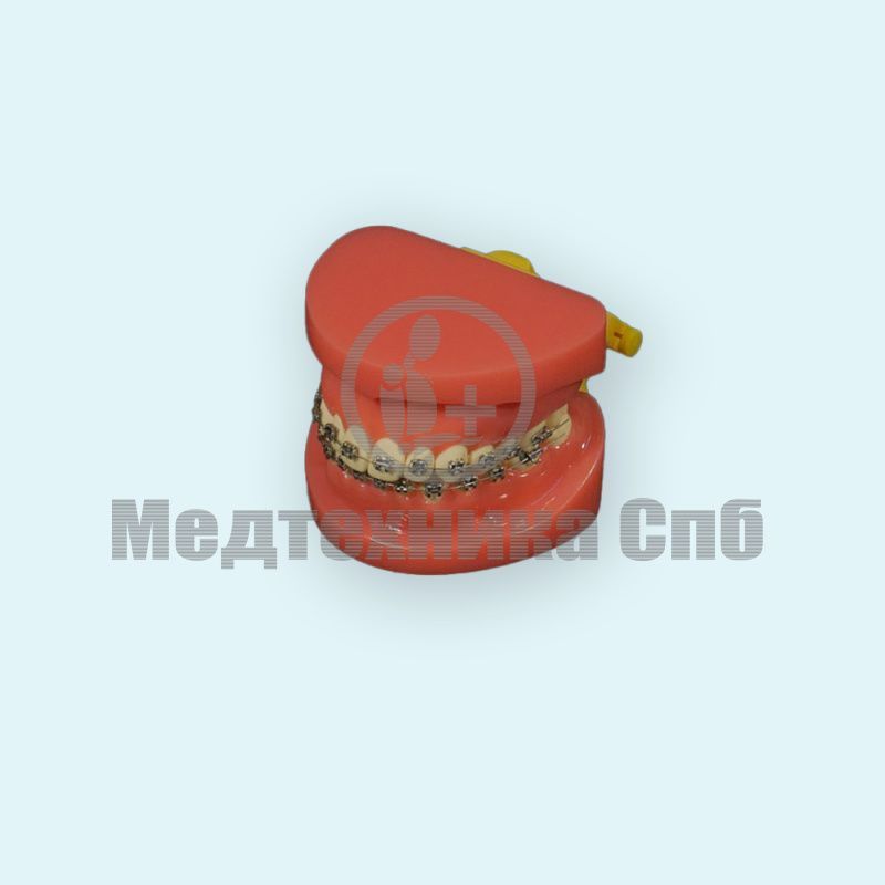 изображение: Ортодонтическая модель с корректирующим устройством (норма)