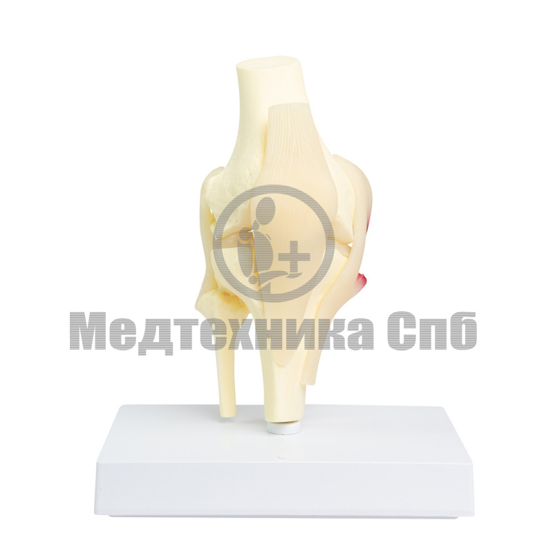 PZ1002 Модель коленного сустава