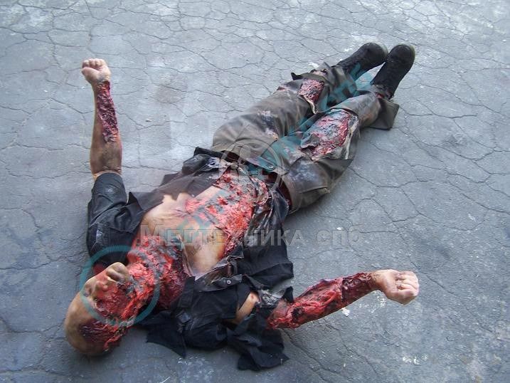 изображение: Фантом-манекен трупа Алан, с ранами от взрыва бомбы, наполовину анатомический