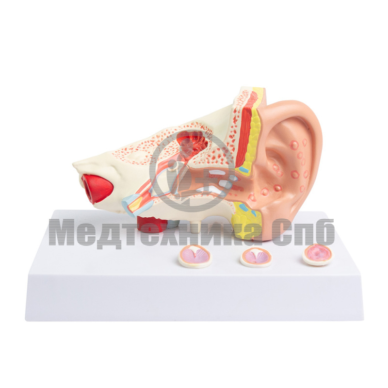 P0761 Модель патологий уха