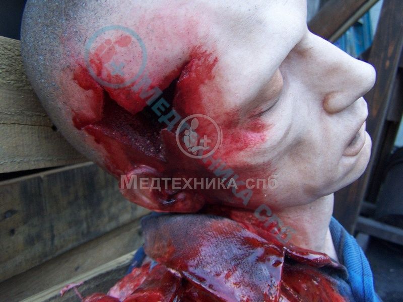 изображение: Фантом-манекен Алан с огнестрельным ранением