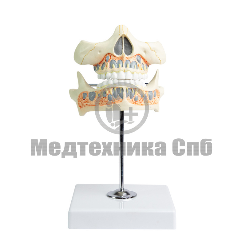 P0530 Модель молочных зубов, 2 части