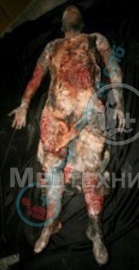 изображение: Фантом-манекен женского тела с ранениями