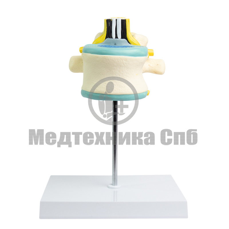 P0645 Модель поясничного позвонка со спинным мозгом