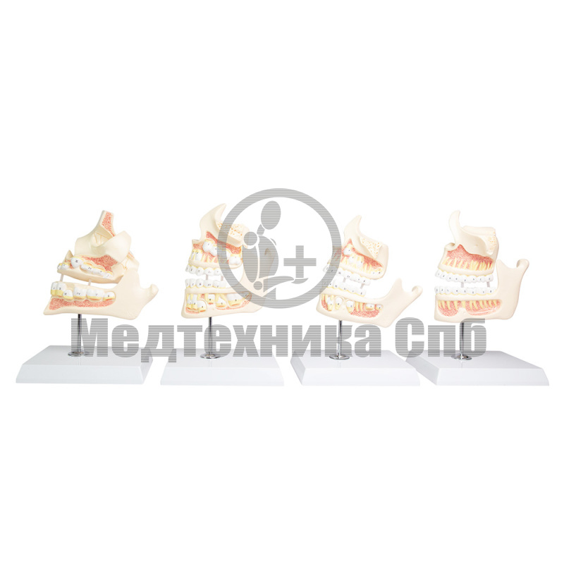 P0538 Модель развития зубов, 4 модели