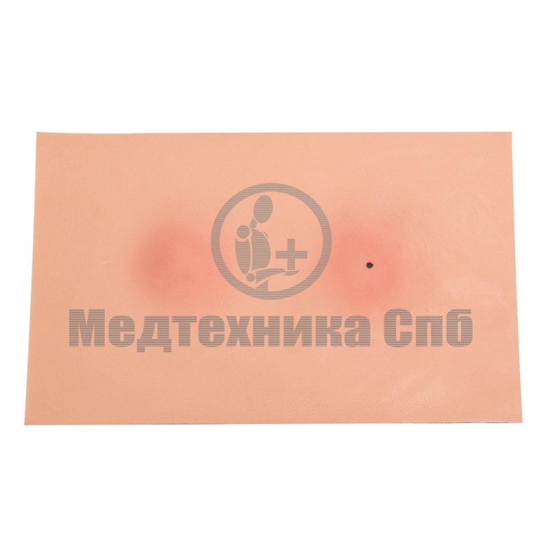 Вскрытие абсцесса