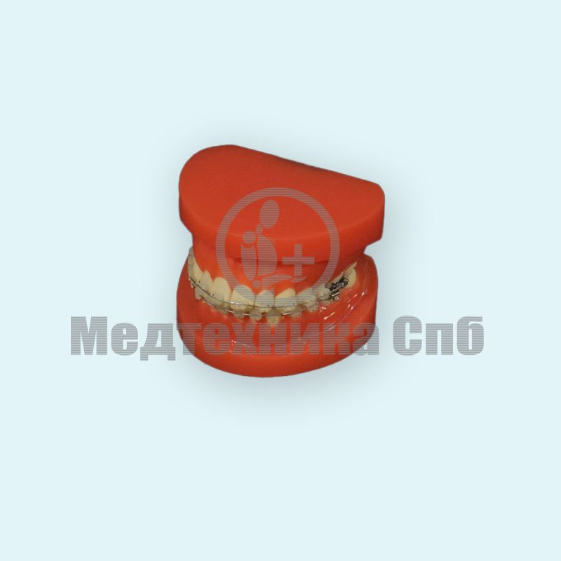 изображение: Ортодонтическая модель с корректирующим устройством (норма)