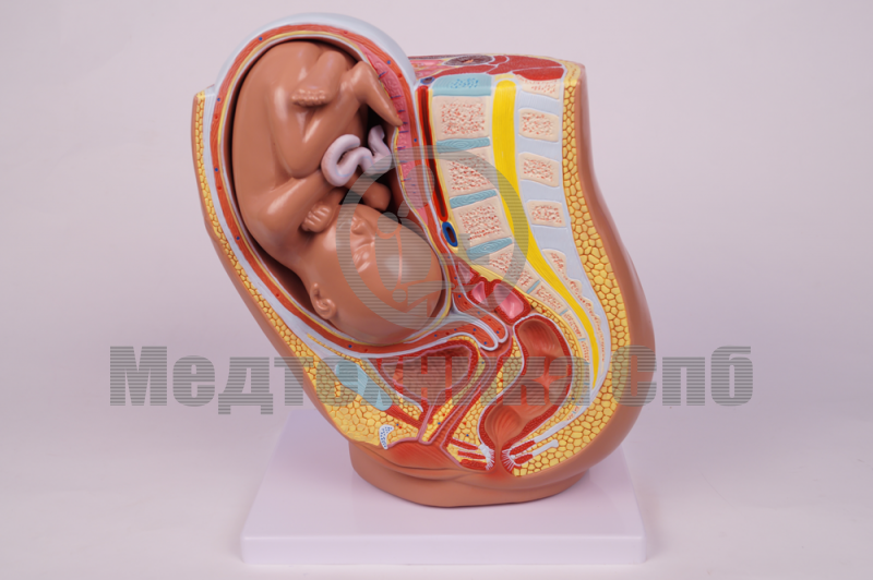 изображение: Модель таза беременной со зрелым плодом
