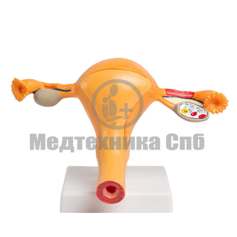 B0106-B Модель матки