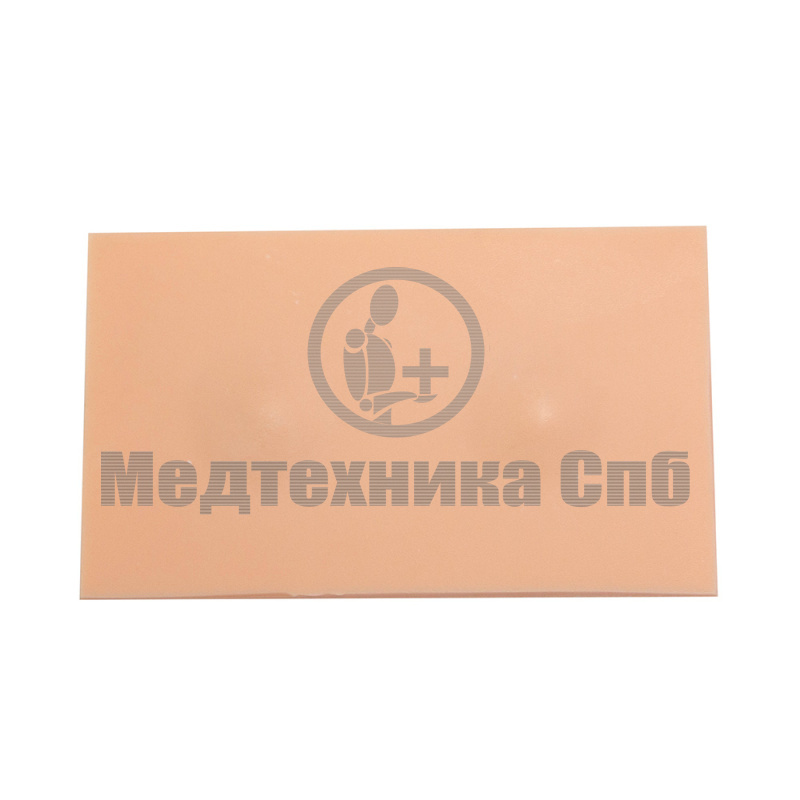 Резекция липомы