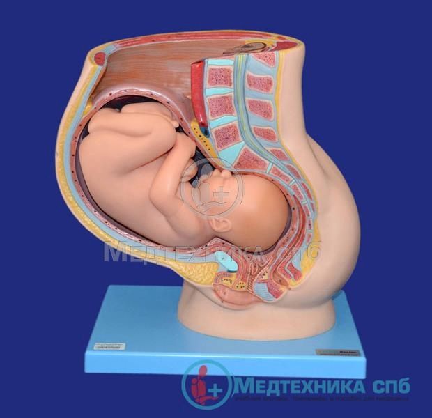 изображение: Модель таза с маткой и плодом на 9-м месяце беременности