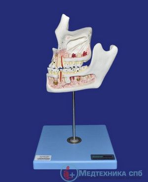 изображение: Модель челюстей с патологией зубов, 2 части