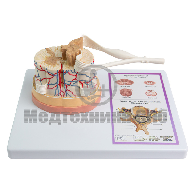 P0620B Модель спинного мозга с нервными окончаниями